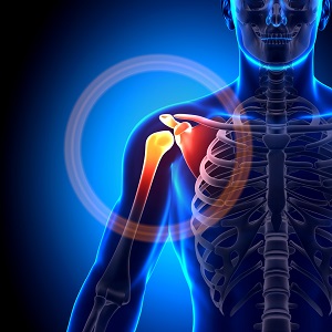 Shoulder Disorders