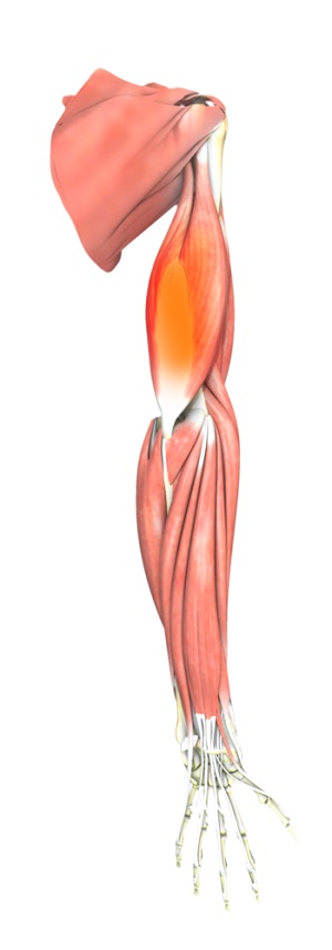 Triceps Tendonitis